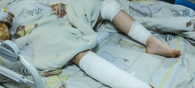 Shelling killed six-year-old Milana's mother. She is now recovering after surgery at a children's hospital in Kyiv, Ukraine. Shelling killed six-year-old Milana's mother. She is now recovering after surgery at a children's hospital in Kyiv, Ukraine.