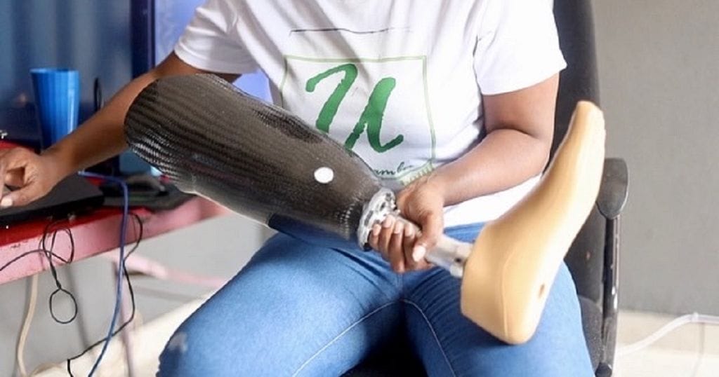 Lowering prosthetic costs through 3D technology » Africa Global Village
