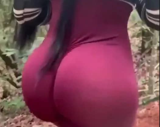 Botched Buttocks Enhancement Procedure